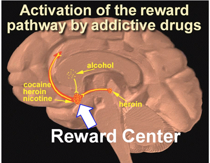 Got Brain Fog? Here's How Alcohol Affects Your Dopamine and Reward System.