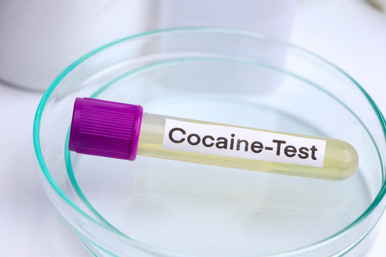 An image of a drug test tube for cocaine.