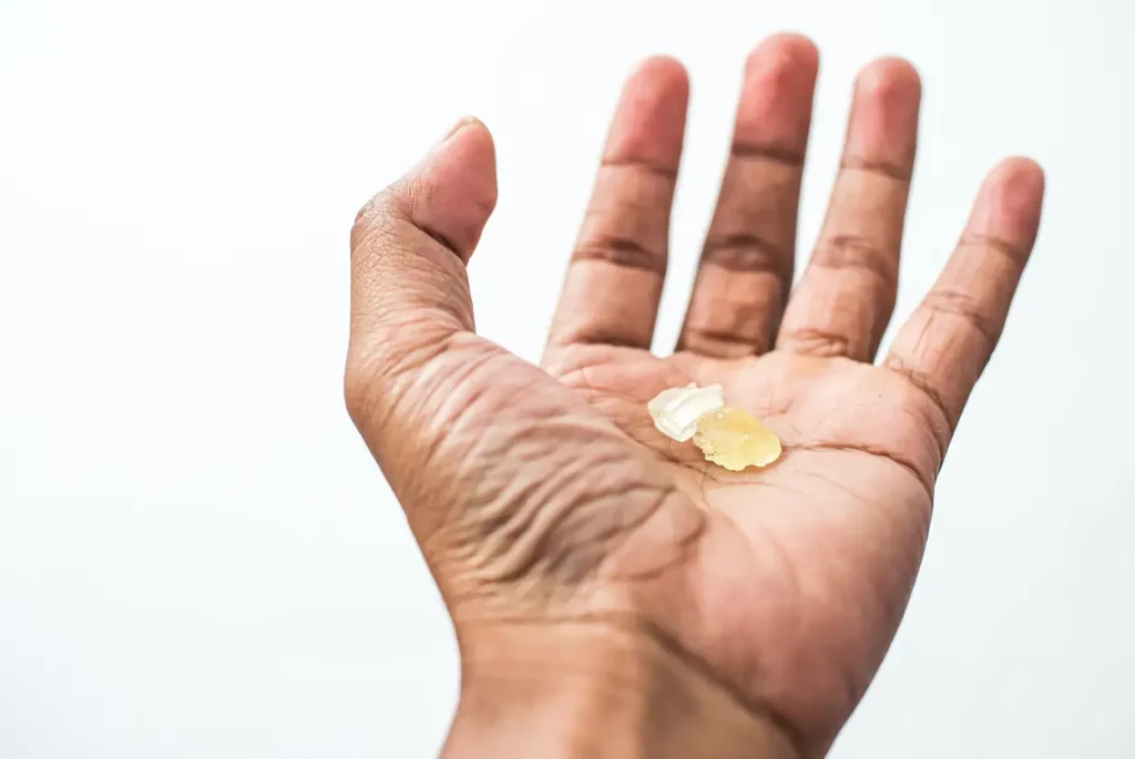 Meth crystals in a hand