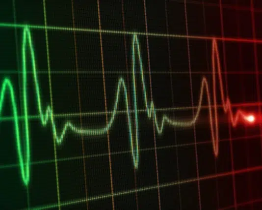 Heart Rate Variability (HRV) Sessions shown on monitor